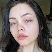 Lindacam