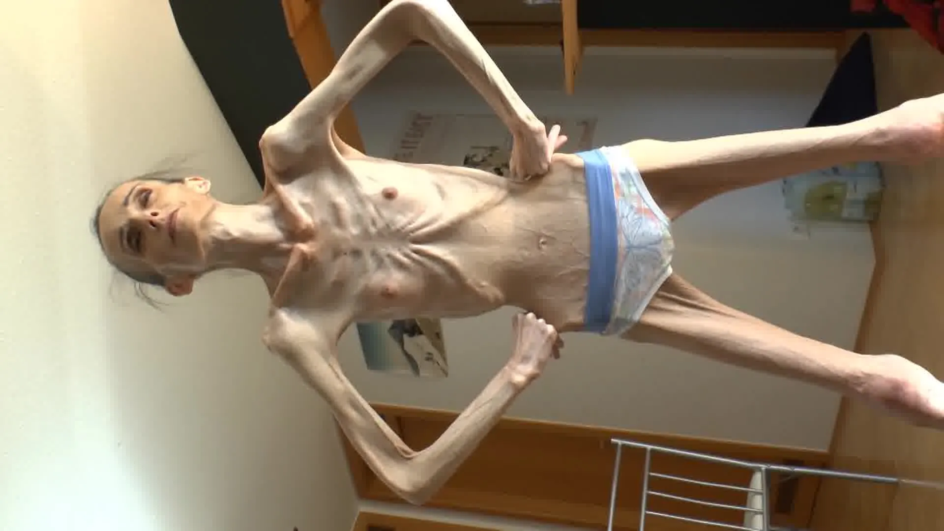 Naked anorexics