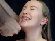 gimbobar huge facial braces first show