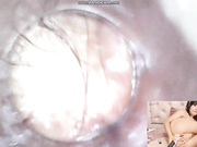 ayumi_tanaka endoscope show(accident)