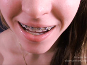 Princess Leia Blow It On My Braces in private premium video