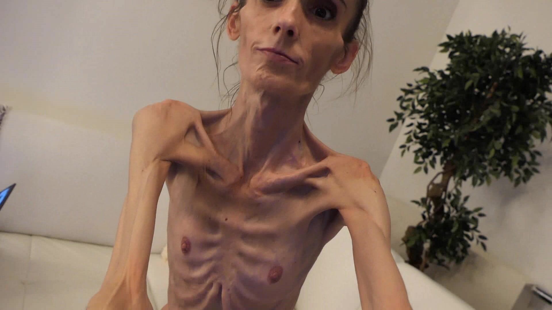 anorexic Denisa 12-07-2021.