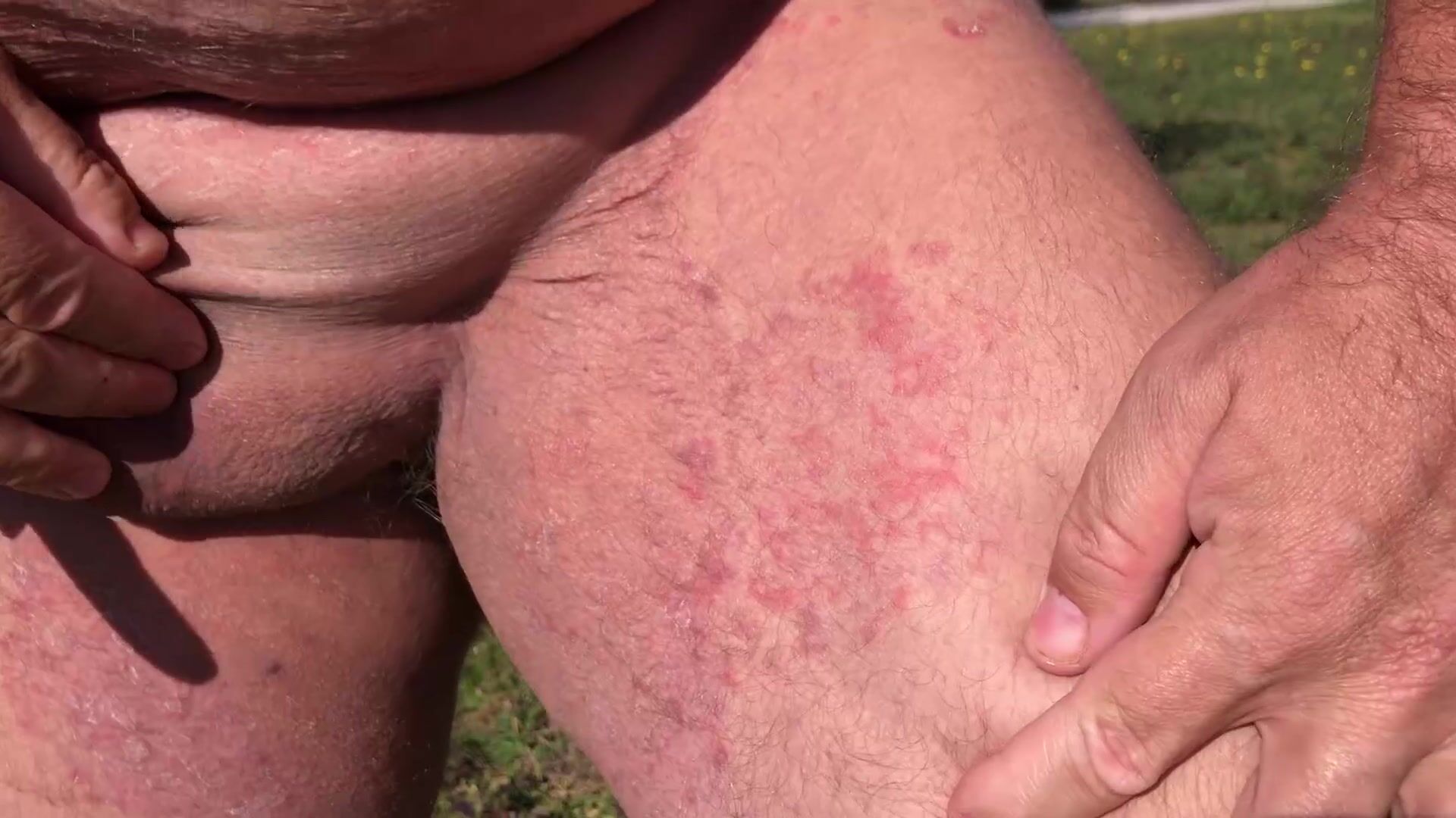 Allergie entre les jambes, Noel Lauffenburger